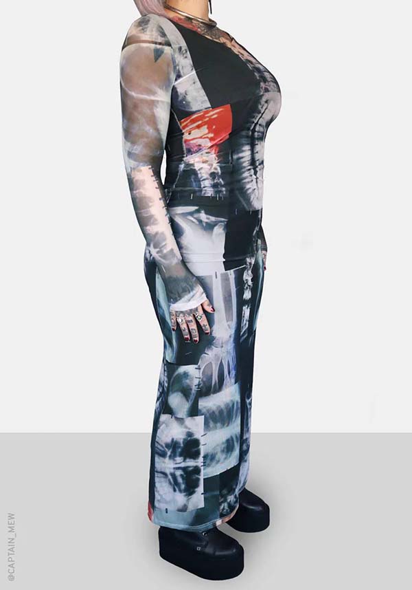 Skeletal | MAXI DRESS*