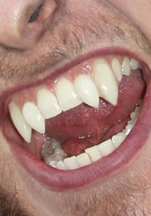 Werewolf Deluxe [CLASSIC & SMALL] | CUSTOM FANGS - Beserk - all, clickfrenzy15-2023, cosmetics, cosplay, costume, cpgstinc, discountapp, fake teeth, false teeth, fangs, fp, halloween, halloween costume, halloween makeup, special fx makeup, teeth, vampire, wolf